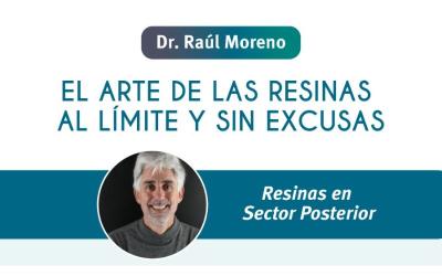 El arte de las resinas al límite y sin excusas