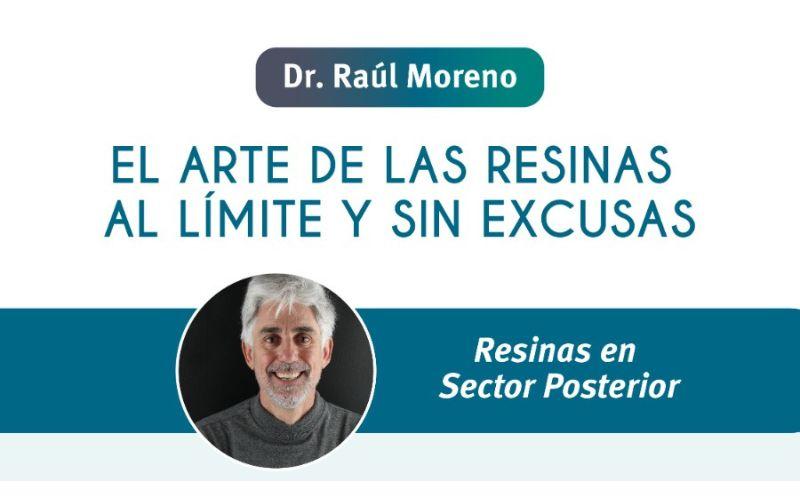El arte de las resinas al límite y sin excusas